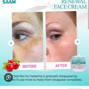 Dark Spot Correcting Cream – Even Tone Formula (3)