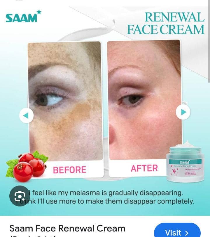 Dark Spot Correcting Cream – Even Tone Formula (3)