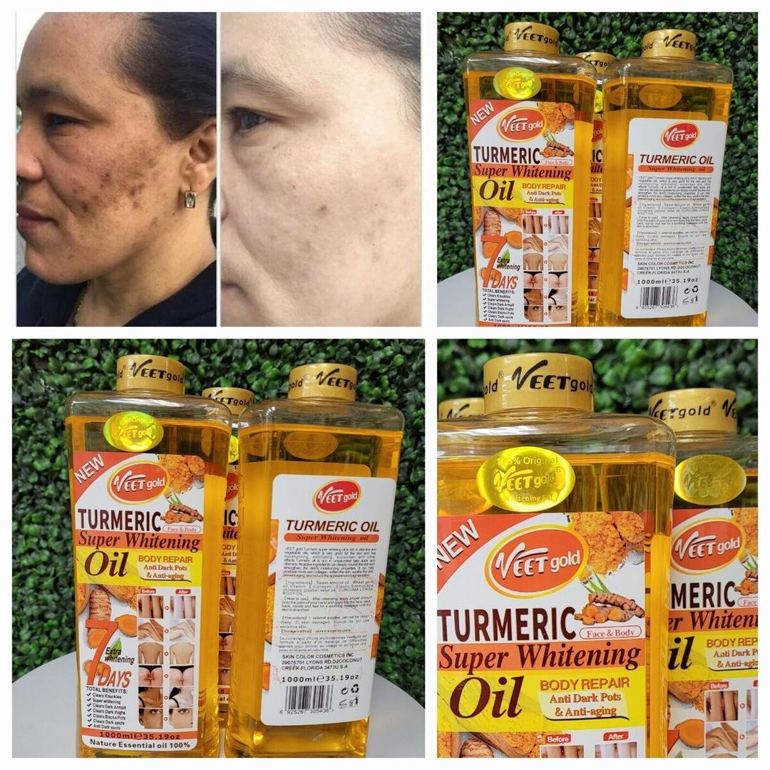 Veetgold Turmeric Body Oil – 100% Natural Skin Brightening & Repair Oil with Anti-Dark Spot & Anti-Aging Benefits – Deep Moisturizing Essential Oil for Glowing Skin