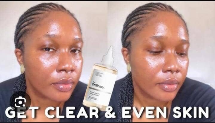 Excellent Peeling Skin Oil Lightening Exfoliating Extra Strength for Face Body (2)