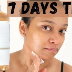 Excellent Peeling Skin Oil – Extra Strength Lightening & Exfoliating Treatment for Face & Body