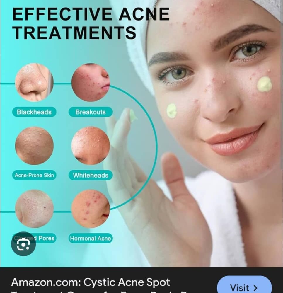 Kormesic Salicylic Acid Acne Removing Gel – 20g (2)