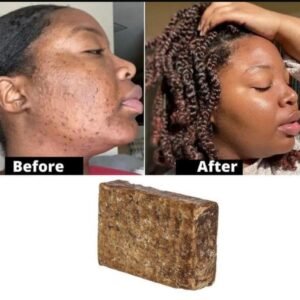 African Raw Black Soap, pure Natural Skincare (2)